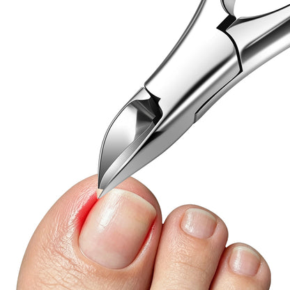 Ingrown Toenail Clippers