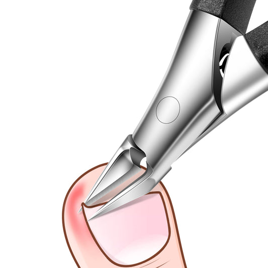 Ingrown Toenail Clippers (Slanted)